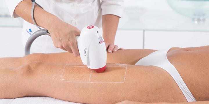 How does the Eneka PRO Laser work?