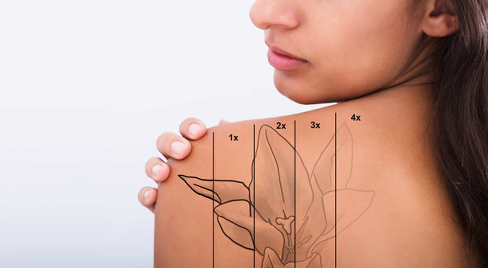 Tattoo-Removal-Lady