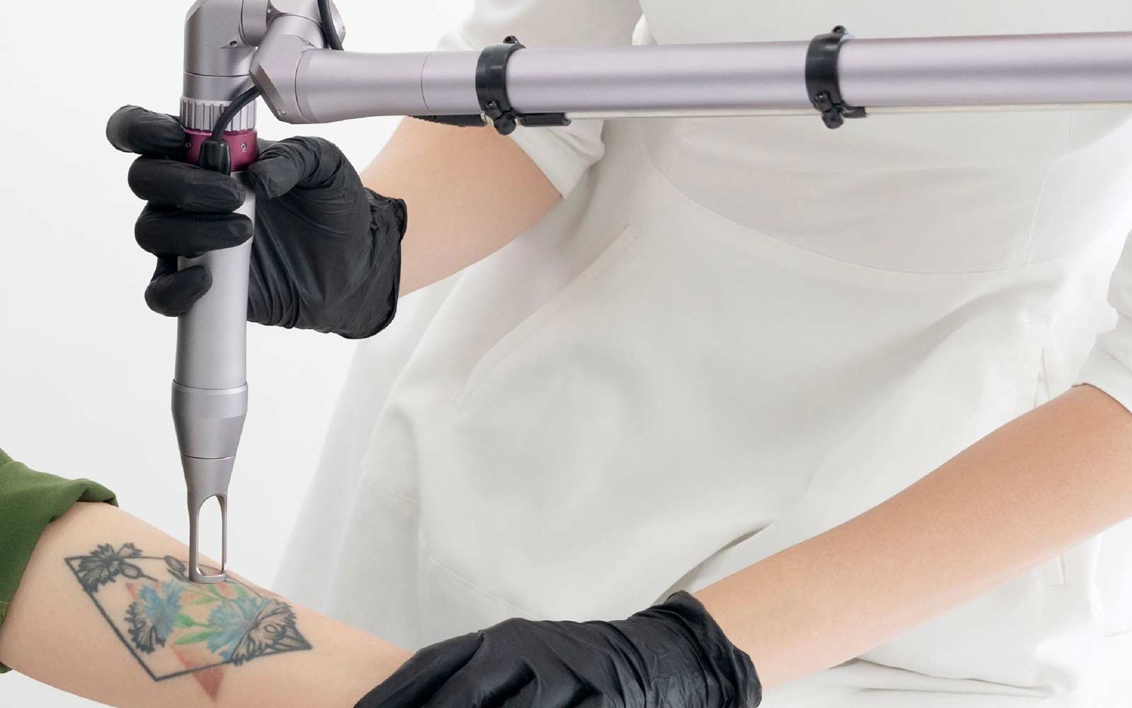 Tattoo-Removal-Treatment
