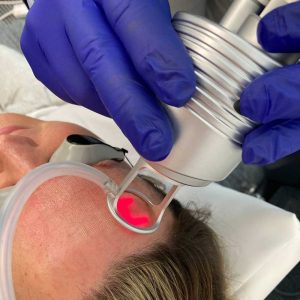 SmartXEL-Treatment-1000